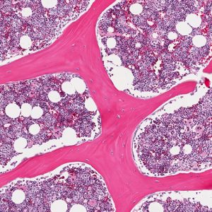 Amniotic Fluid & Chronic Villus Cells