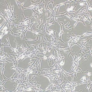 Human mesenchymal stem cell culture